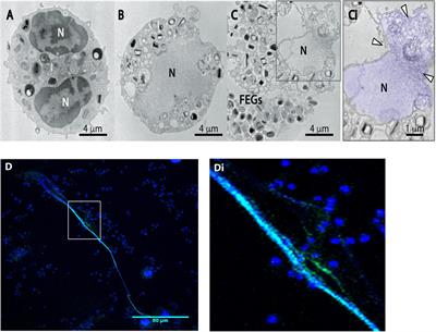 Structural and Signaling Events Driving Aspergillus fumigatus-Induced Human Eosinophil Extracellular Trap Release